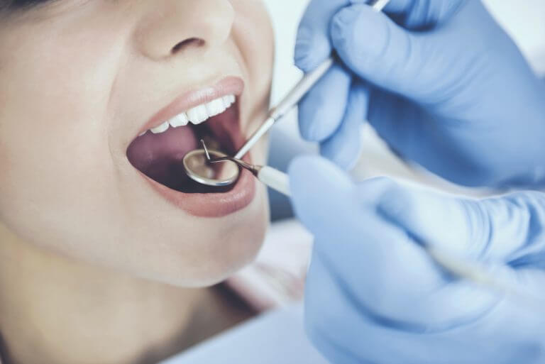 Dental veneers Implant Sacramento CA