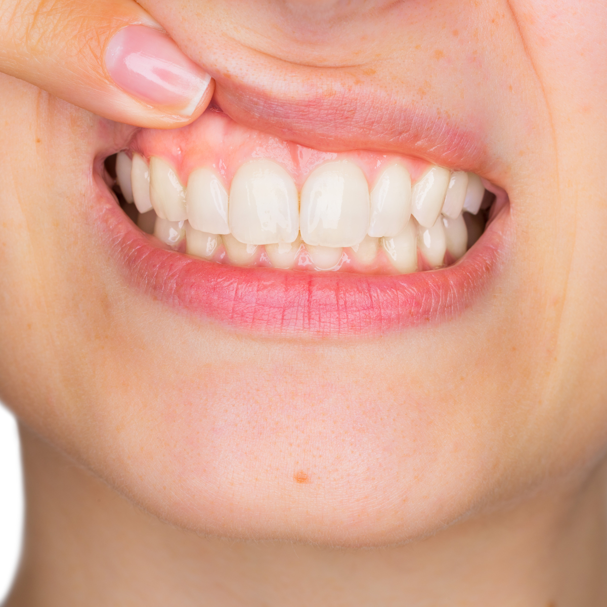 Gum Disease Treatment