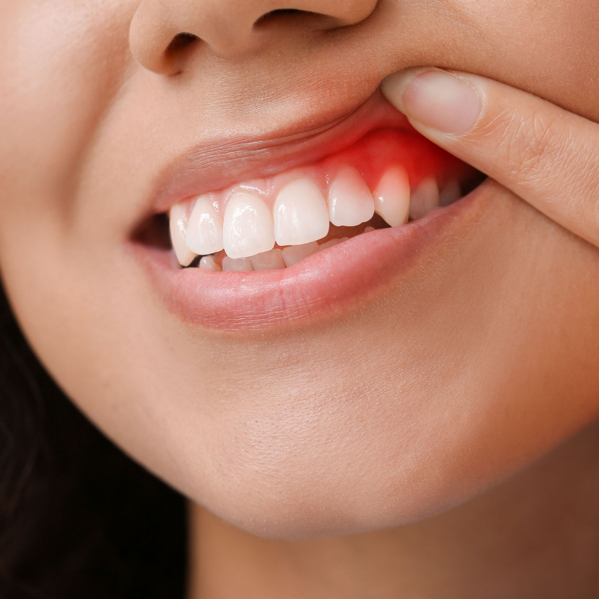 A. Scott Grivas III, DDS, INC. | Best Periodontist Near Me Periodontal Care Treatment